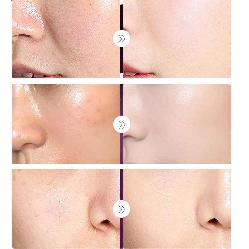 Crema Noble de lujo para mujer - Luxury Skincare Women reseña y precio